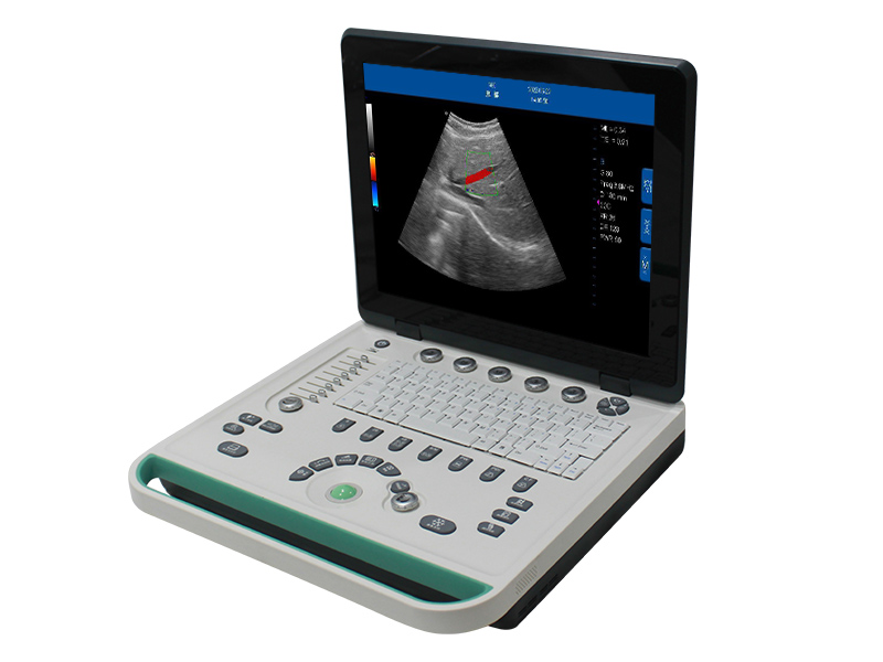 C5Pre Farbe Doppler Ultraschall Diagnose System