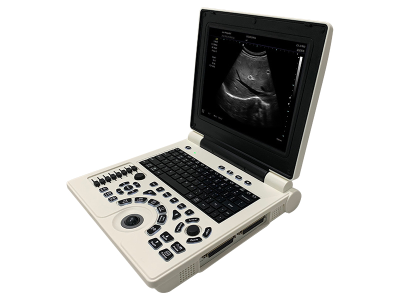 SS-9B All Digital Laptop Ultraschall Diagnose Instrument