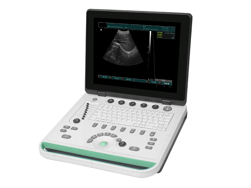 SS-9 voll digitales Ultraschallbildgebendes Diagnosegerät
