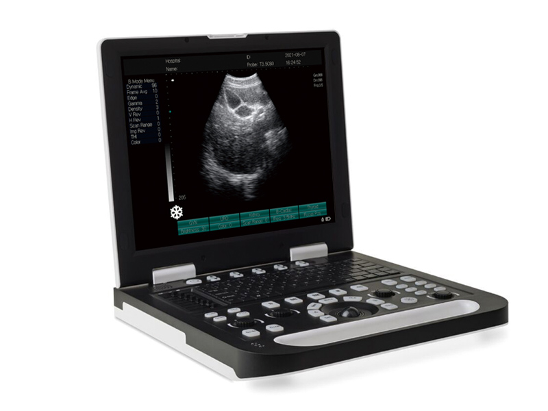 SS-10 voll digitales tragbares Ultraschalldiagnostik-Instrument