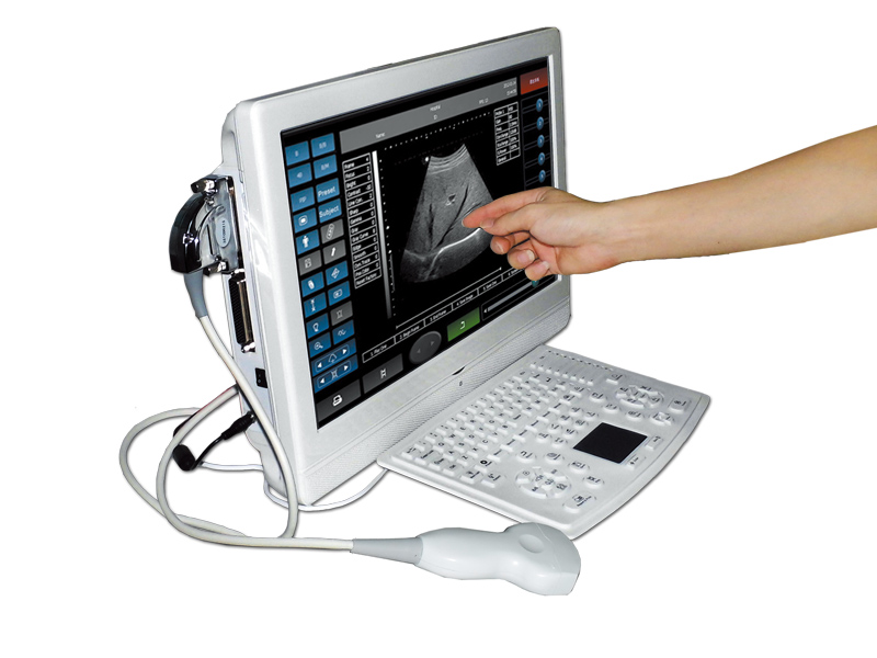 UTouch-8 voll digitales Touchscreen Ultraschall Diagnosegerät