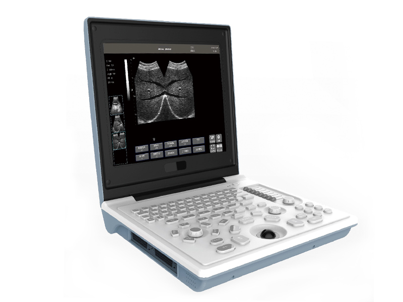 SS-6B Laptop Alle digitalen Ultraschall Diagnose Instrument