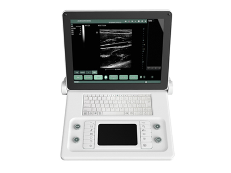 SS-8B All Digital Ultraschall Diagnose System