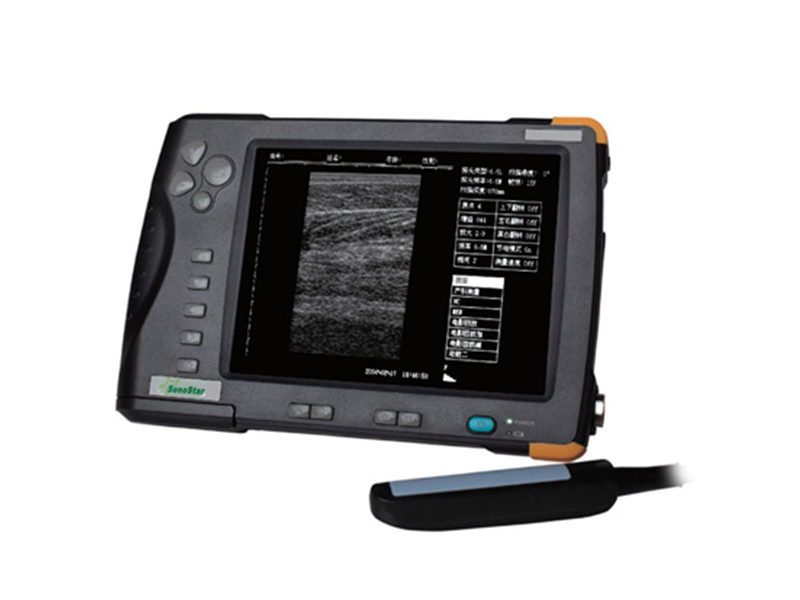 V5 Handheld B-Ultraschall Schwangerschaftstester (Ultraschallbildgebung diagnostisches Instrument)