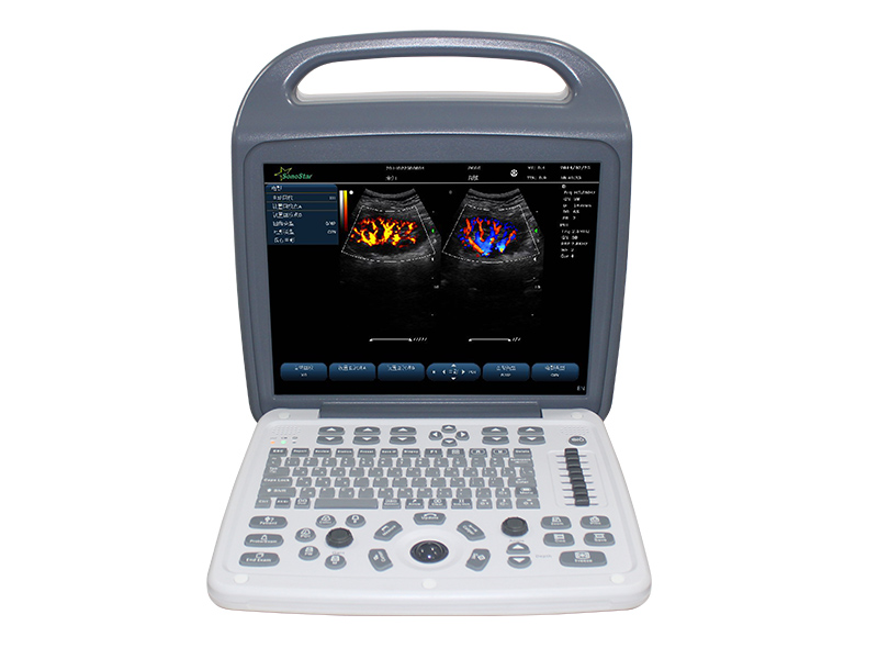 C10M tragbare Farbe Ultraschall B-Ultraschall Farbe Ultraschall diagnostische Instrument Doppler