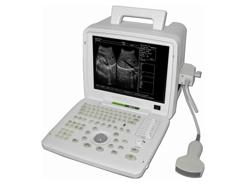 SS-6 voll digitales Ultraschallbildgebendes Diagnosegerät (B-Ultraschall)