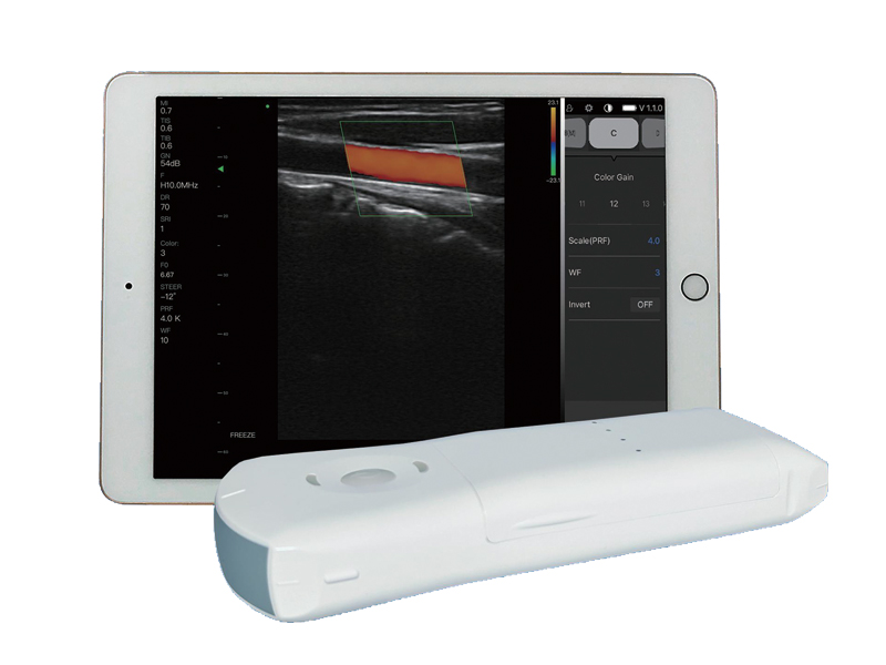 10CPL 3in1 Palm Doppler Ultraschall
