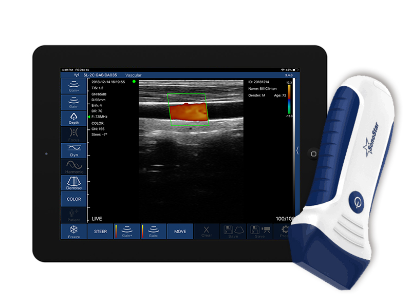 7L高配线阵无线探头式掌上彩超