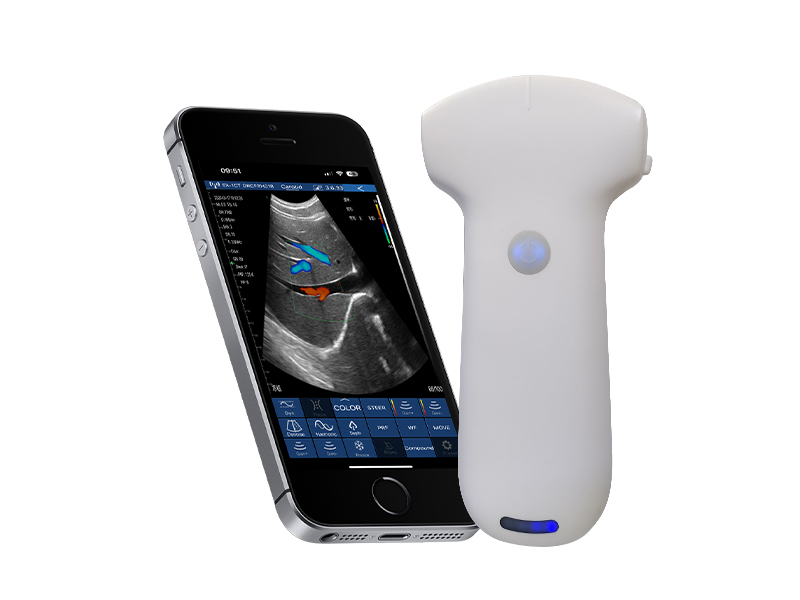 8C 高配凸阵无线探头式掌上彩超