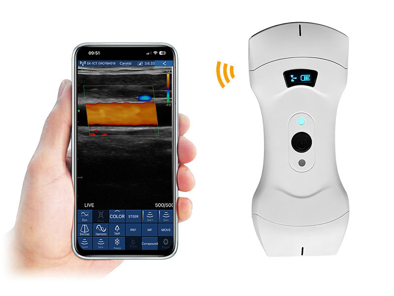 6CPL Plus 3in1 Palm Doppler Ultraschallscanner