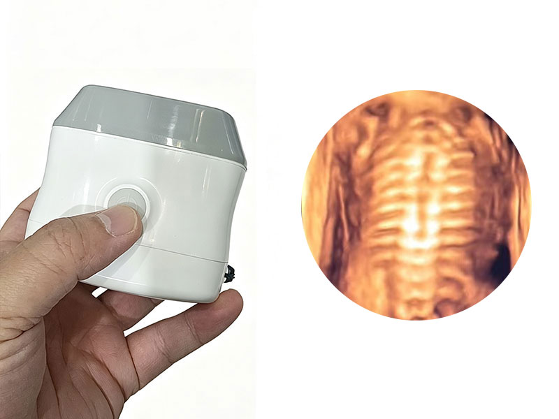 Tragbares Linear Array 4D 3D Imaging Ultraschall