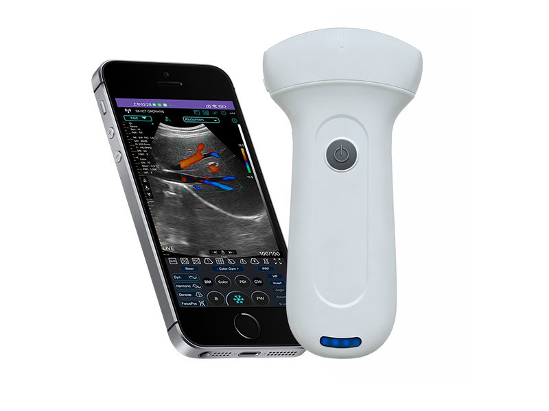 7C konvexer Palmdoppler Ultraschallscanner