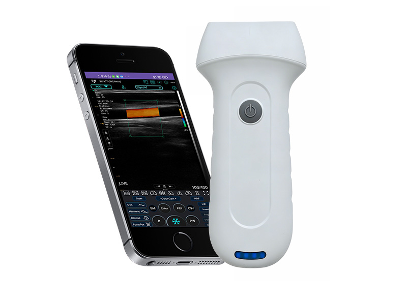 7L linearer Palm Doppler Ultraschallscanner