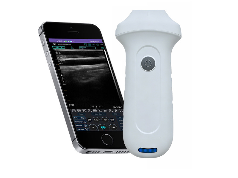 7N linearer Palm Doppler Ultraschallscanner