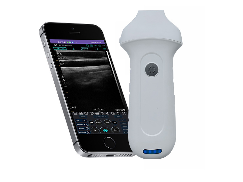7H linearer Palm Doppler Ultraschallscanner (VIP exklusiv)