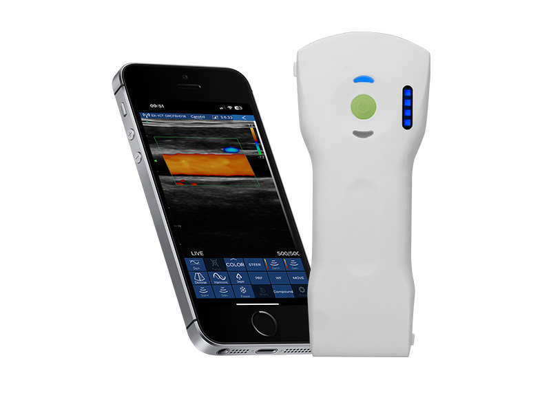 7CPL 3in1 Palm Doppler Ultraschallscanner (VIP exklusiv)