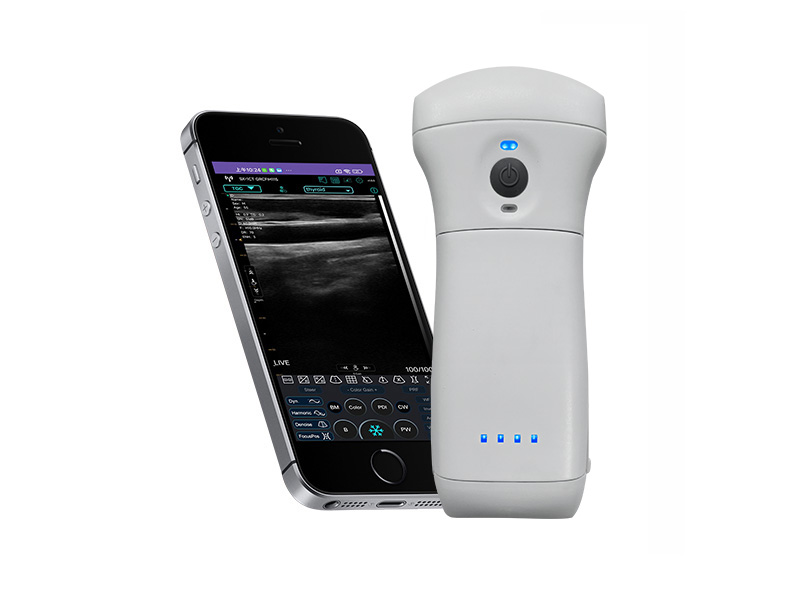 9CPL Austauschbare Batterie 3in1 Palm Doppler Ultraschallscanner (VIP exklusiv)