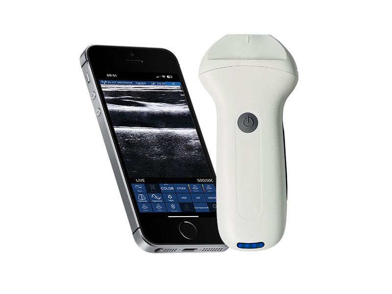 8N linearer Palm Doppler Ultraschallscanner