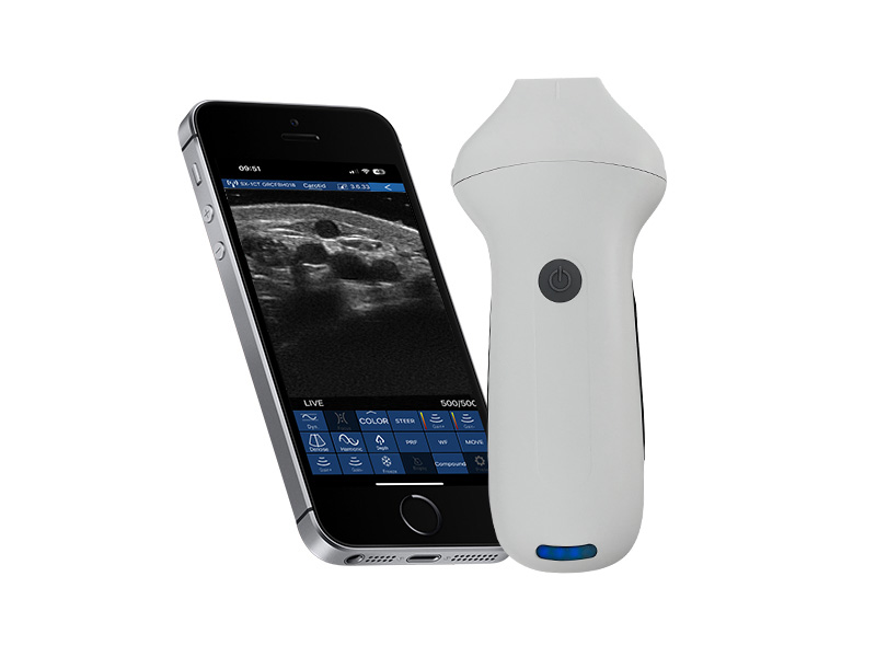 8H linearer Palm Doppler Ultraschallscanner