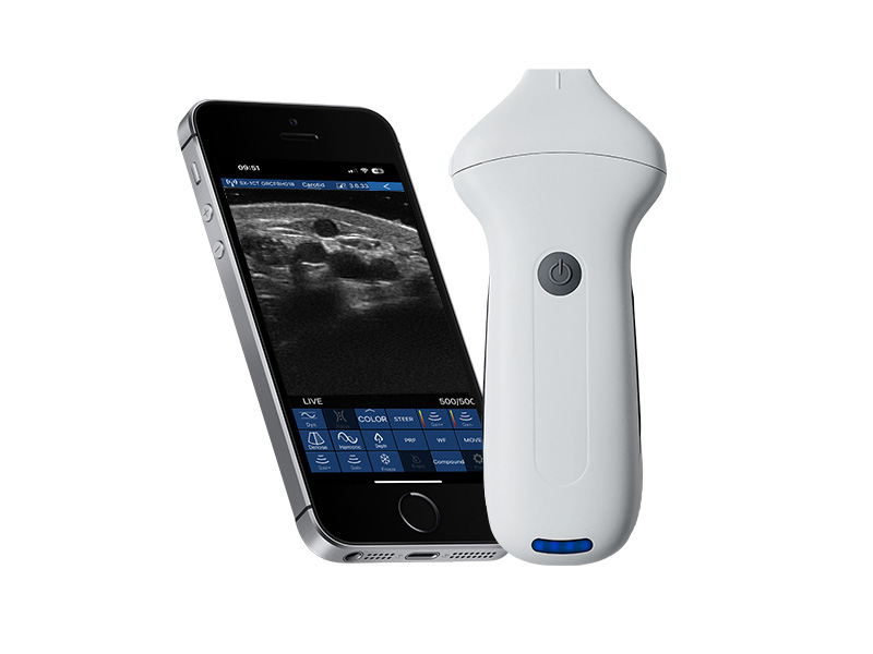 8S linearer Palm Doppler Ultraschallscanner