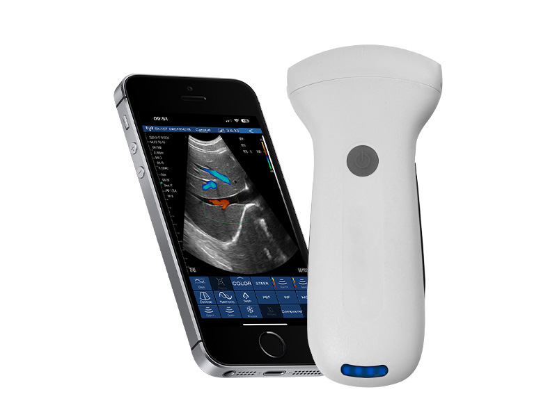 8C konvexer Palmdoppler Ultraschallscanner