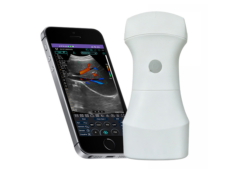 9C Austauschbare Batterie konvex Palm Doppler Ultraschall