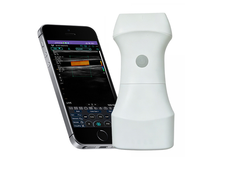 9L Austauschbare Batterie lineare Palm Doppler Ultraschall-Scanner (VIP exklusiv)