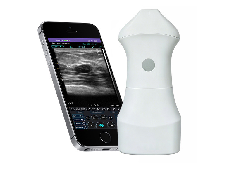 9S Austauschbare Batterie lineare Palm Doppler Ultraschall