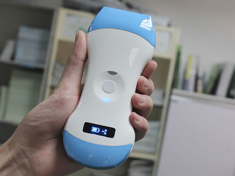 无线掌上彩超设备采购：医疗机构选型实用指南