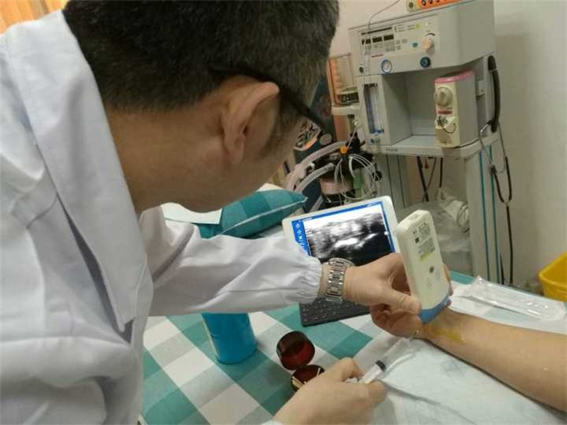 掌上超声：正在改变基层医疗的口袋诊断室